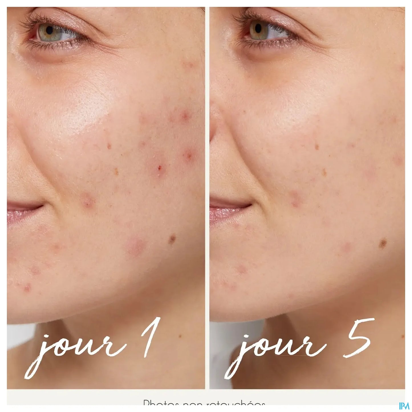 Siero purificante anti-imperfezioni 30 ml