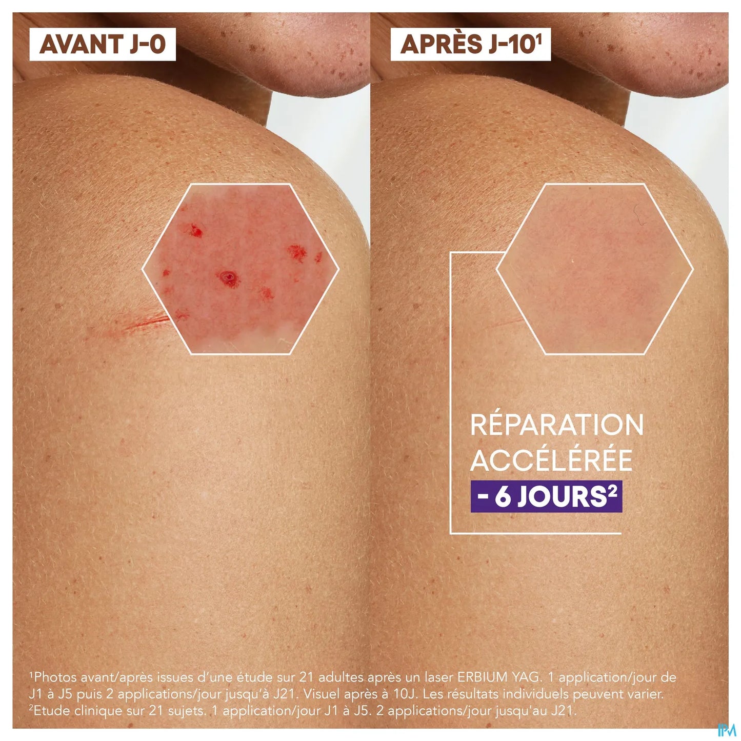A Derma Epitheliale Ultra Repair Crème Réparatrice Anti Marques 40 mL