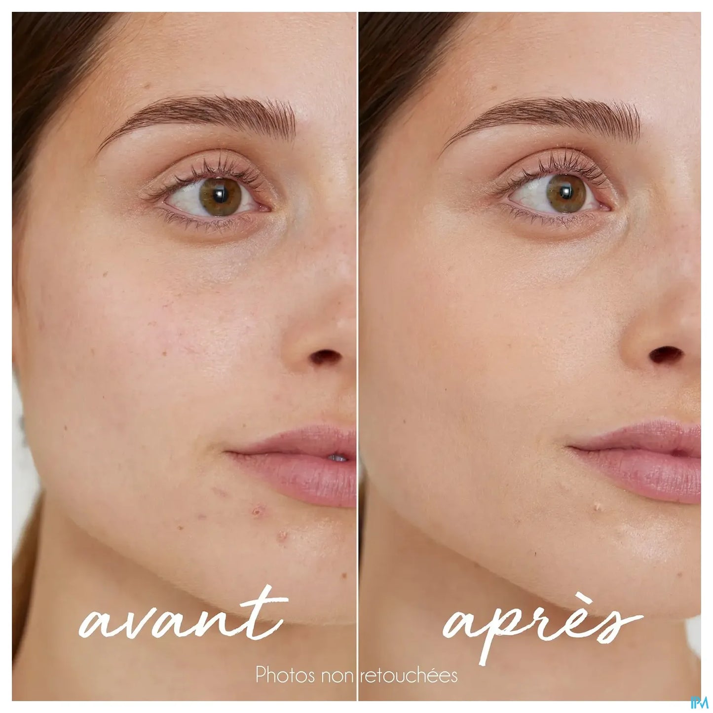 Tinted Anti-Imperfections Concealer Stick 5.5g