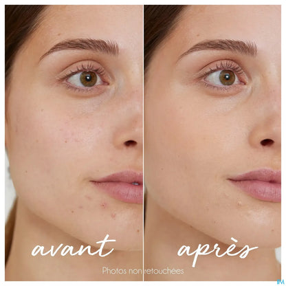 Tinted Anti-Imperfections Concealer Stick 5.5g