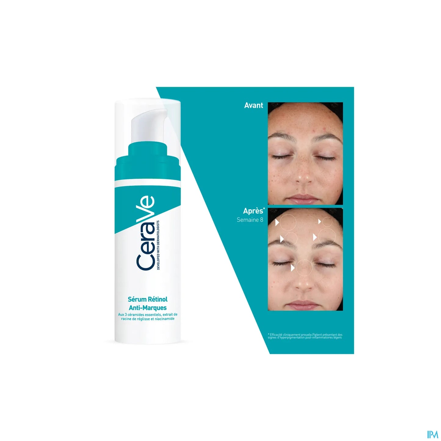 Retinol Resurfacing Serum 30ml