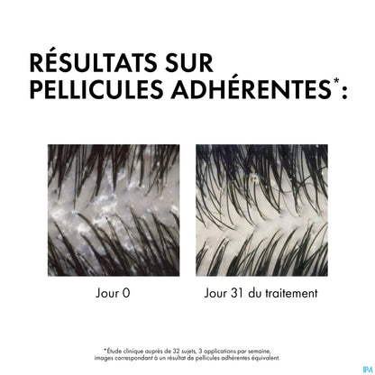 Dercos Anti-Pelliculaire Shampooing Traitant Eco-Recharge Cheveux Gras 400ml