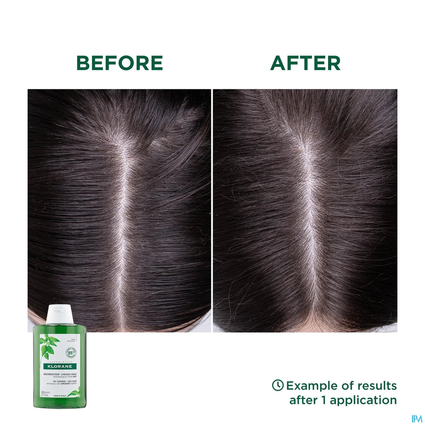 Shampooing Séborégulateur à l'Ortie pour Cheveux Gras 200ml
