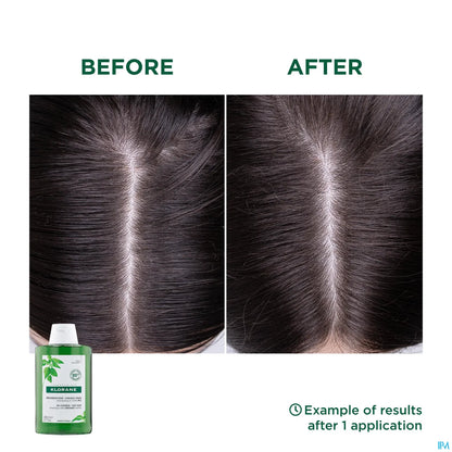 Shampooing Séborégulateur à l'Ortie pour Cheveux Gras 200ml