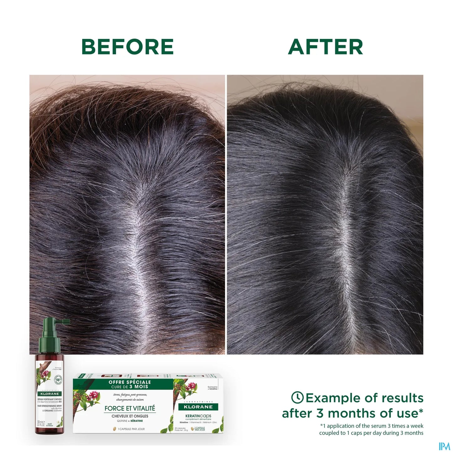Keratincaps Food Supplement Capsules Hair Nails 90 Capsules