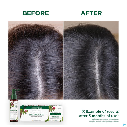 Keratincaps Food Supplement Capsules Hair Nails 90 Capsules