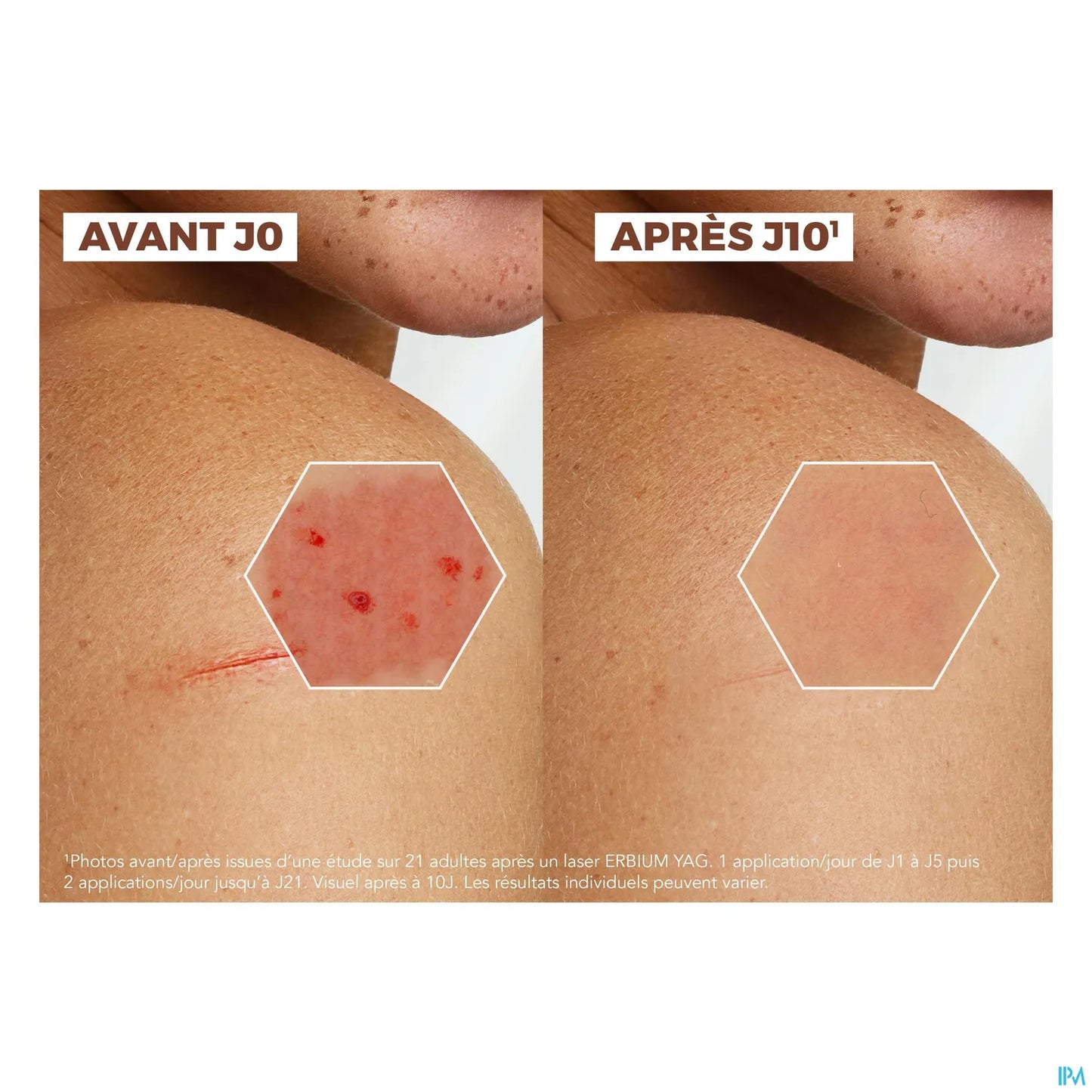 A Derma Epitheliale Ultra Repair Crème Réparatrice Anti Marques 100 mL