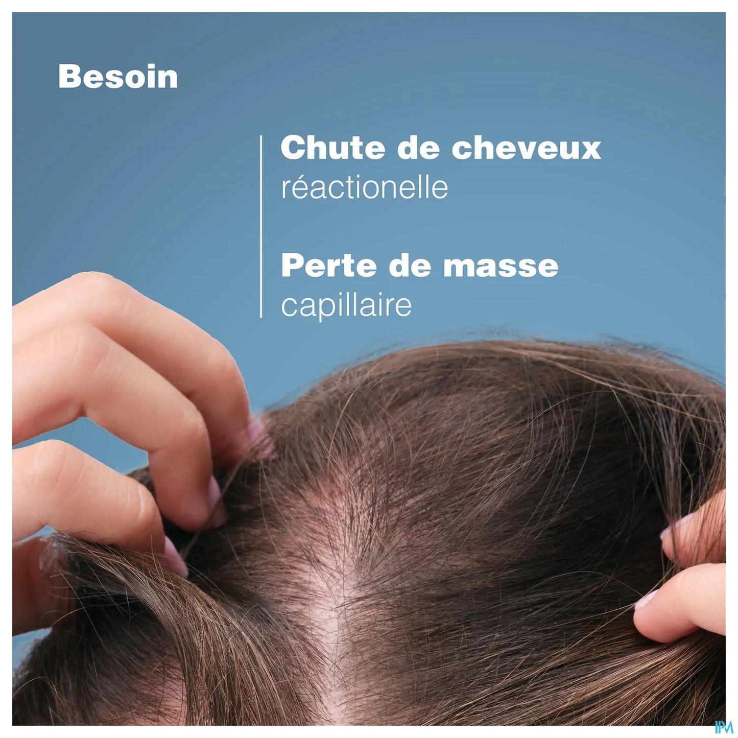 Creastim Reactiv Anti-Hair Loss Lotion 60ml