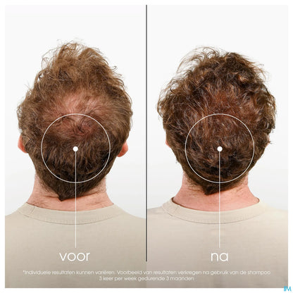 Shampooing à la Quinine et Edelweiss Bio 400ml